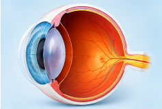 Eye Diseases Understand common eye diseases and their symptoms, including cataracts, glaucoma, dry eyes, and refractive errors