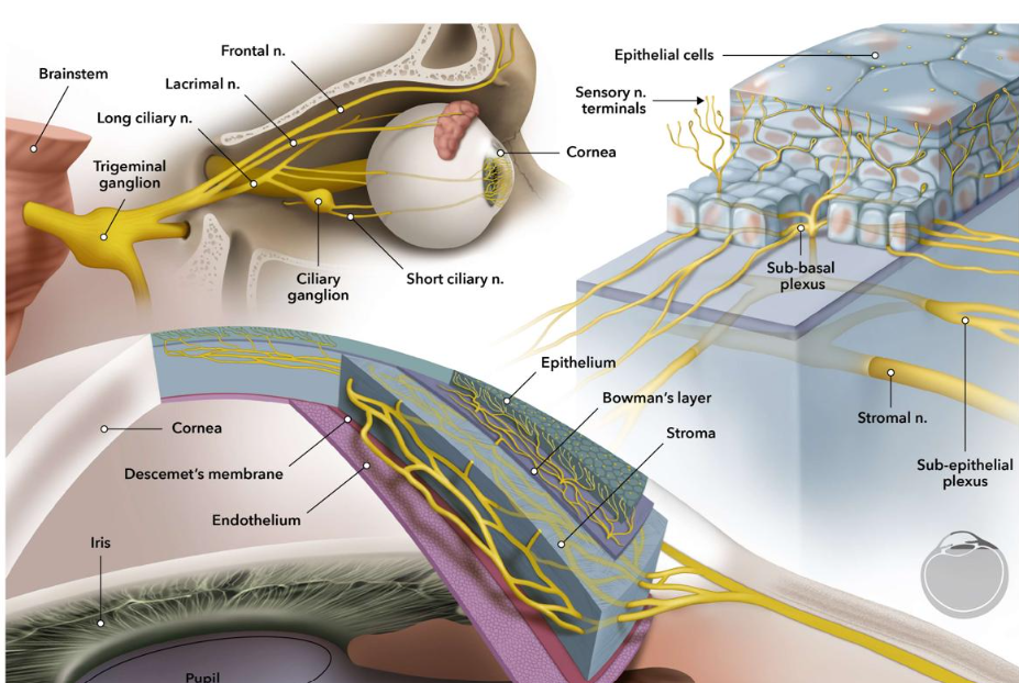 Dry Eyes After LASIK: Why Does It Happen? Dry eyes after LASIK infographic showing eye irritation, redness, reduced tear production, and Dr. Ripan Kaur Kamra’s eye care branding.