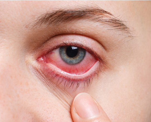 Warning Signs After Eye Surgery: When Should You See a Doctor? types of eye pain symptoms